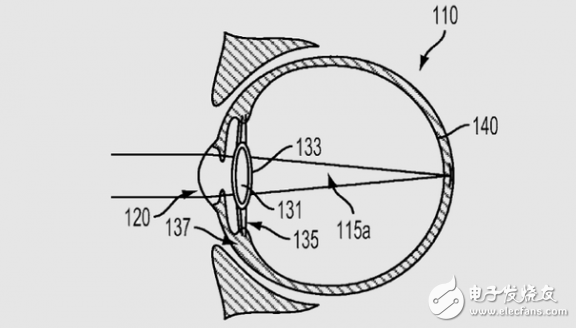 谷歌新专利用电子眼替换晶状体：能矫正近视眼还能拍照,第2张