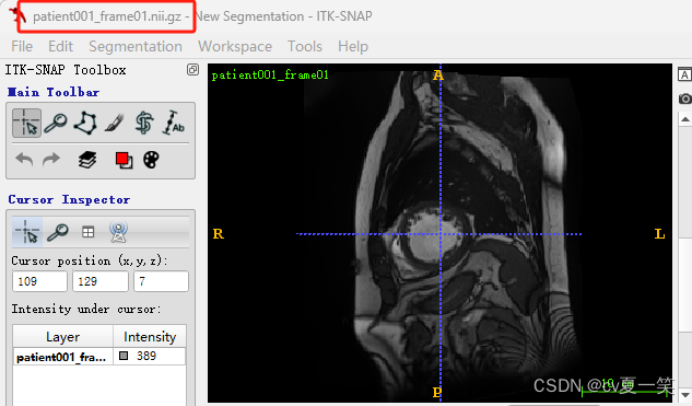 【ACDC数据集】：预处理ACDC心脏3D MRI影像数据集到VOC数据集格式，nii转为jpg，label转为png,在这里插入图片描述,第5张